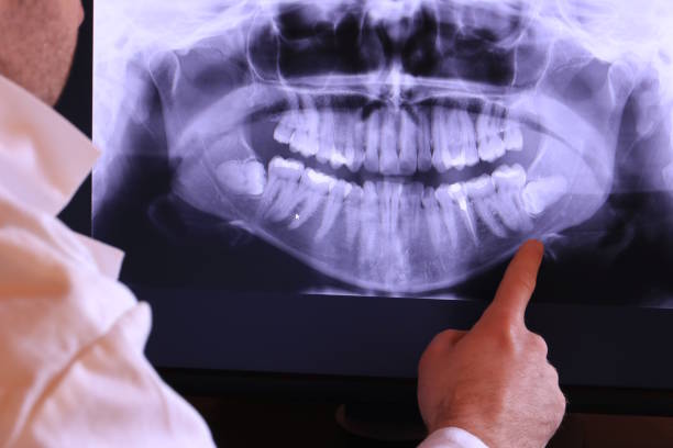 Best Urgent Care for Lost Fillings or Crowns in Horton, KS